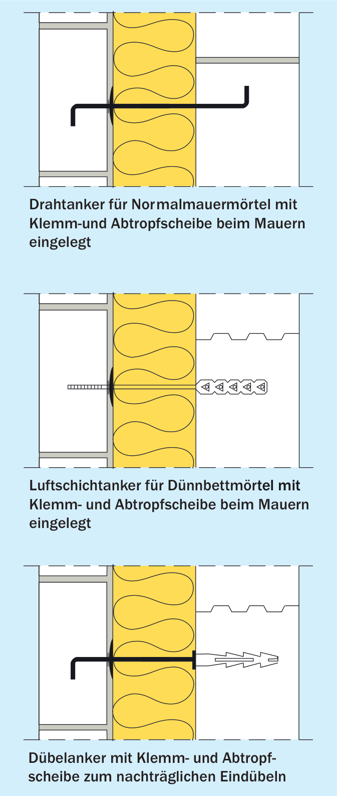 Varianten der Verankerung